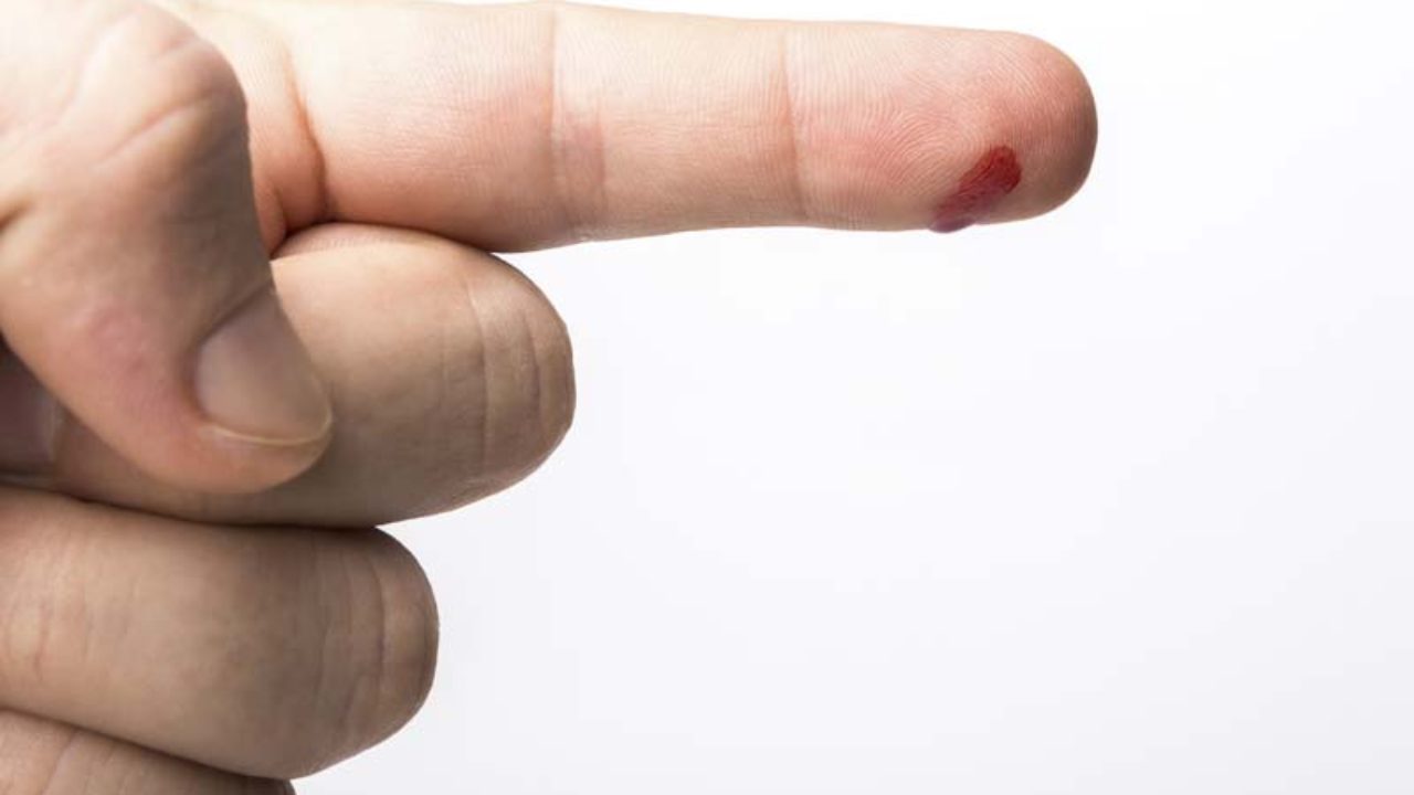 Blood Typing SE